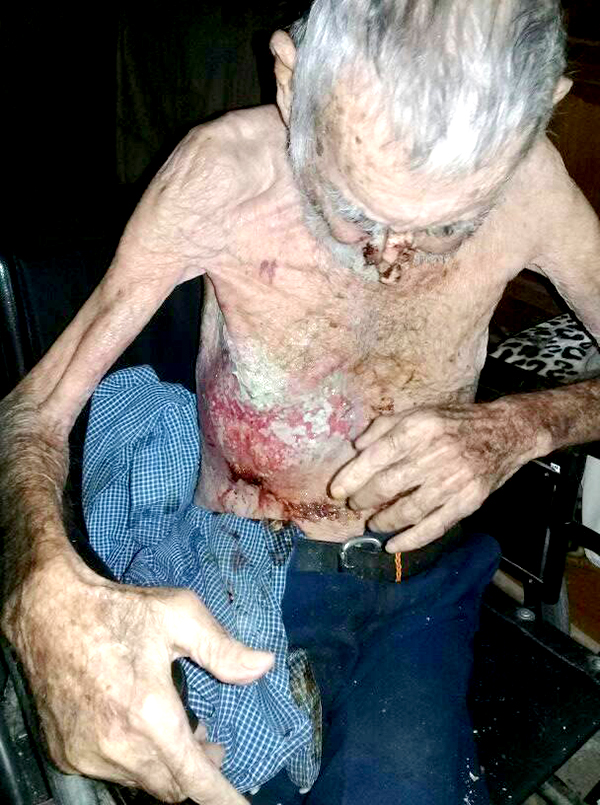 Cáncer de abuelito de Río Bravo le da pocas esperanzas de vida