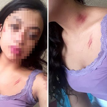 Golpean e intentan raptar a estudiante de enfermería y nadie la ayuda